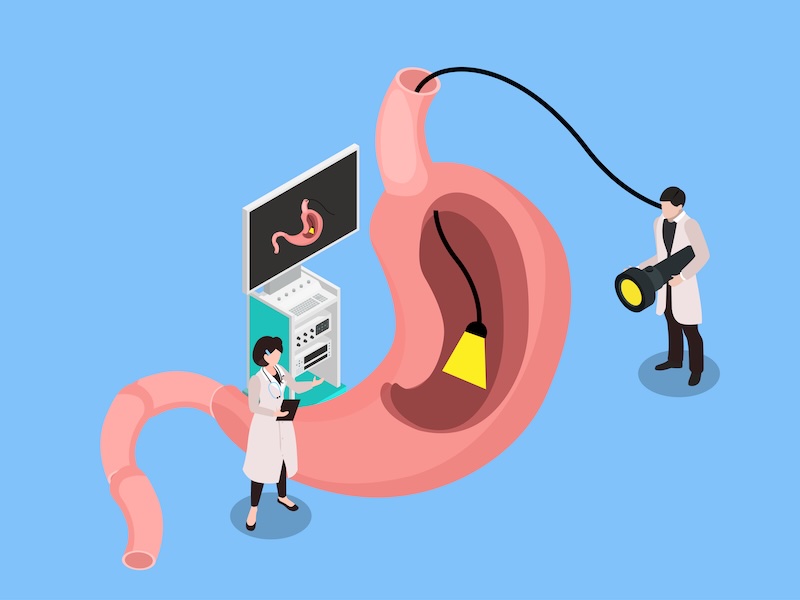 >Identification of Peptic Ulcers