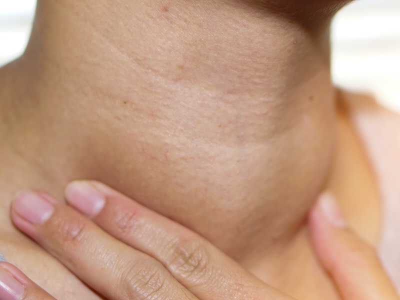 >Common Thyroid Concerns
