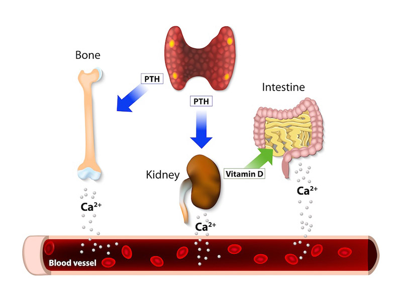 >Parathyroid Abnormalities