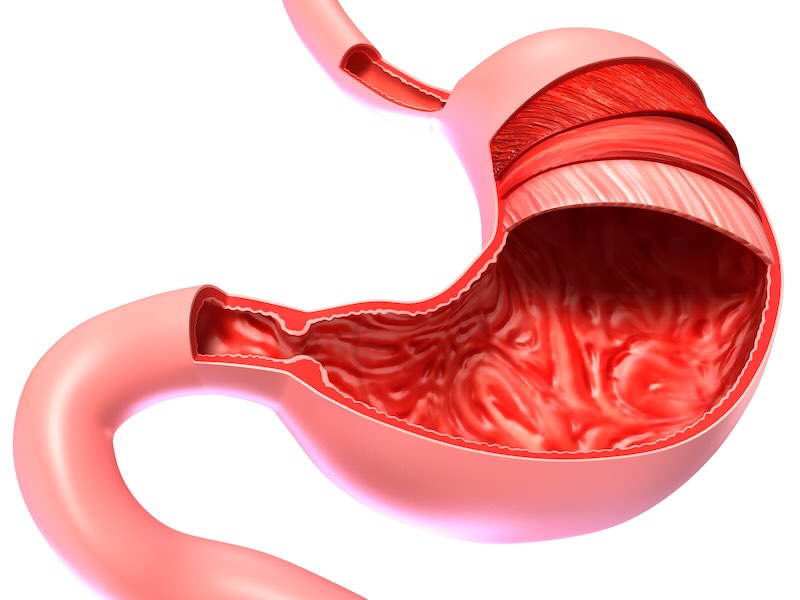 >About The Stomach