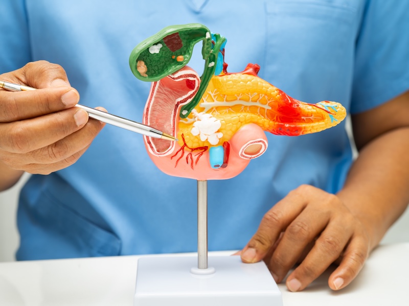 >Acute Cholecystitis